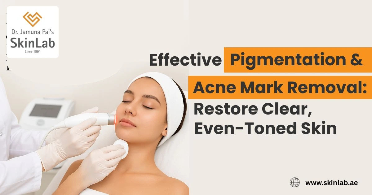 Effective Pigmentation & Acne Mark Removal