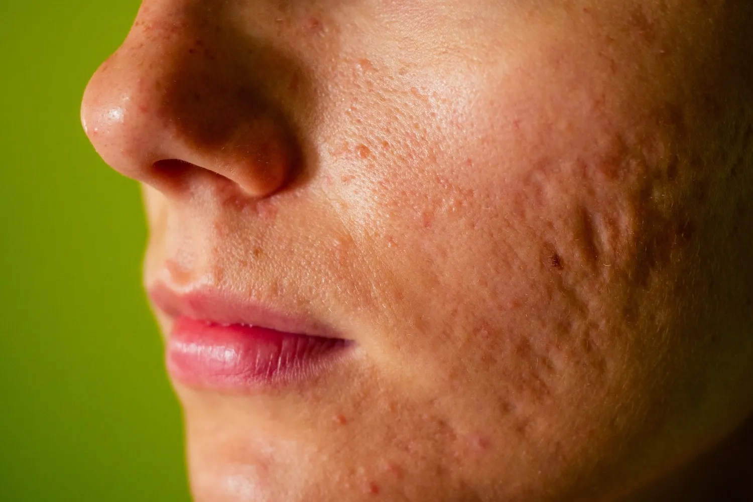 How to Improve Skin Condition