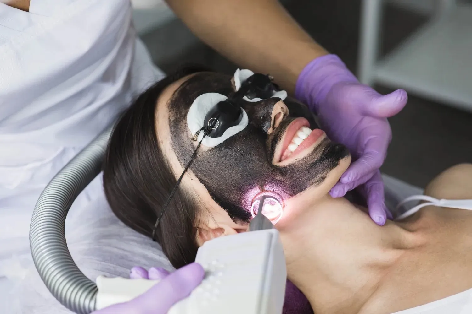 carbon facial Dubai