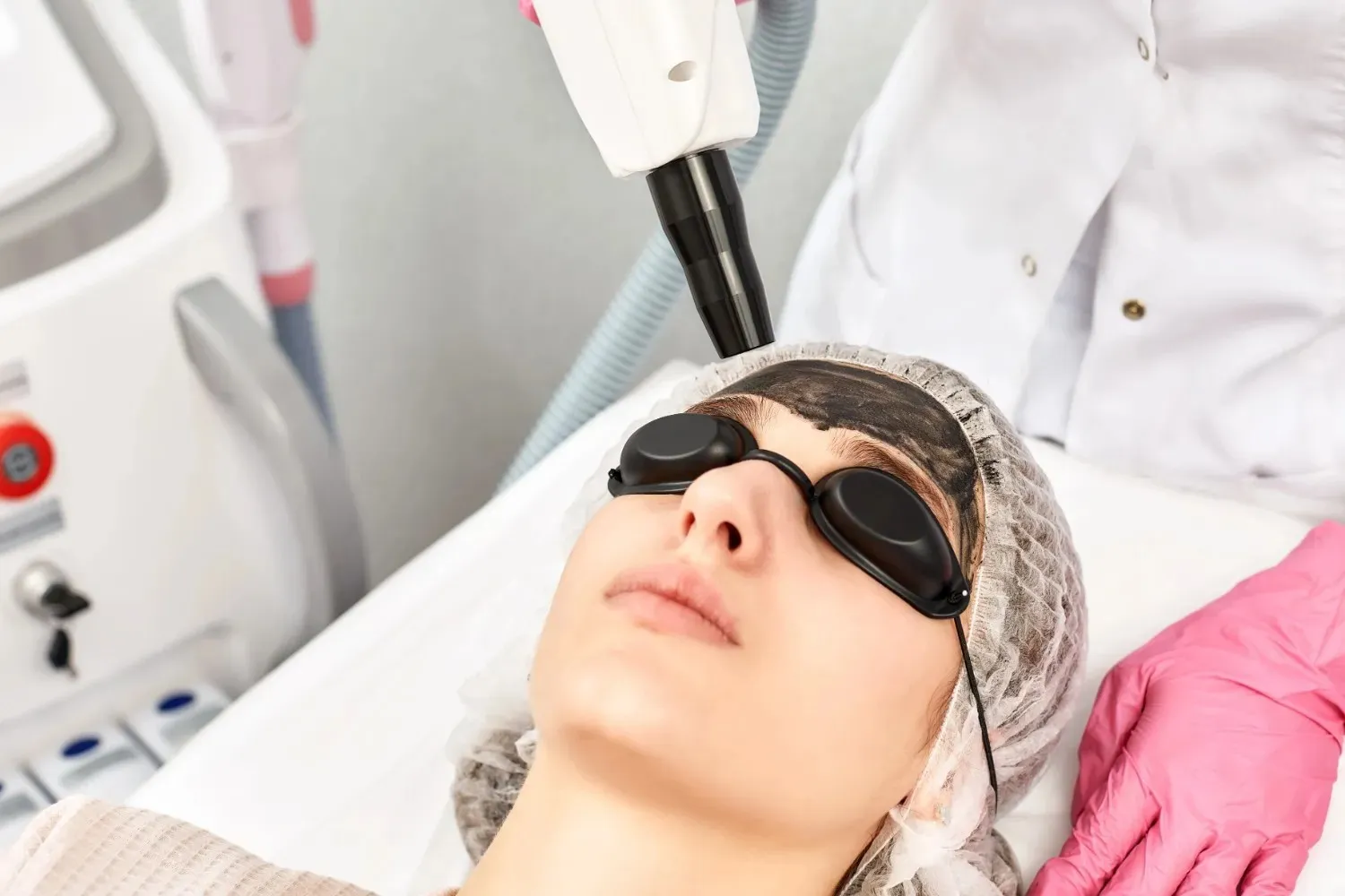 carbon laser in Dubai