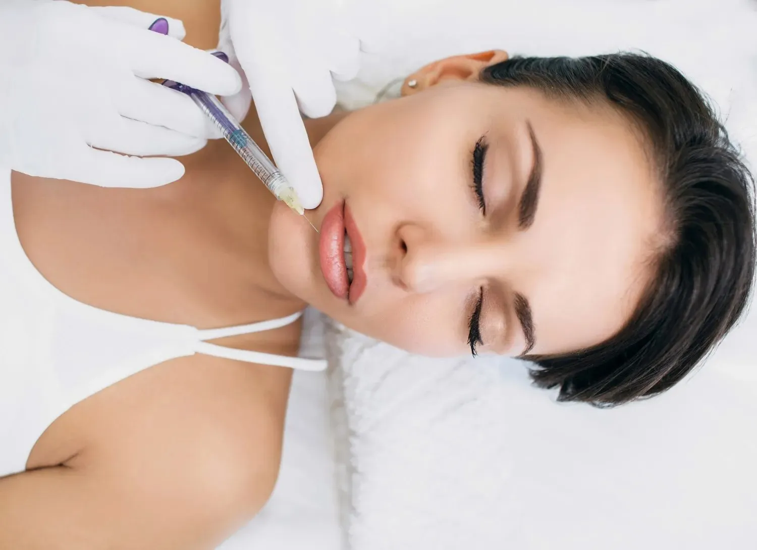 derma needling Dubai