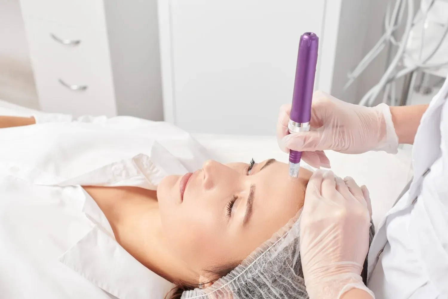 microneedling Dubai