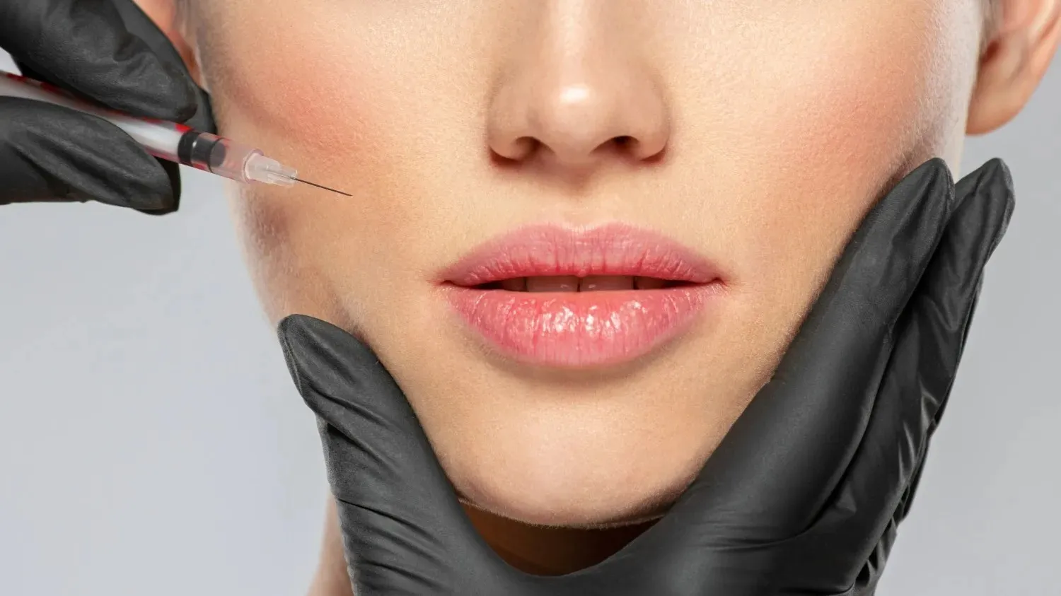 dermal fillers in Dubai