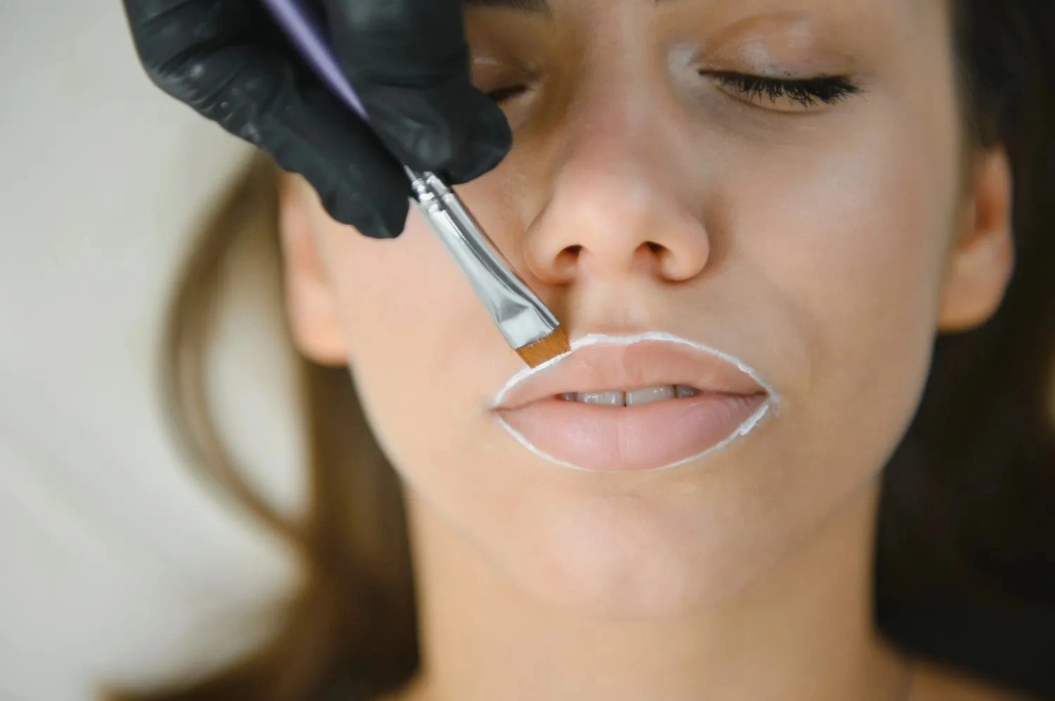 lip enhancement Dubai