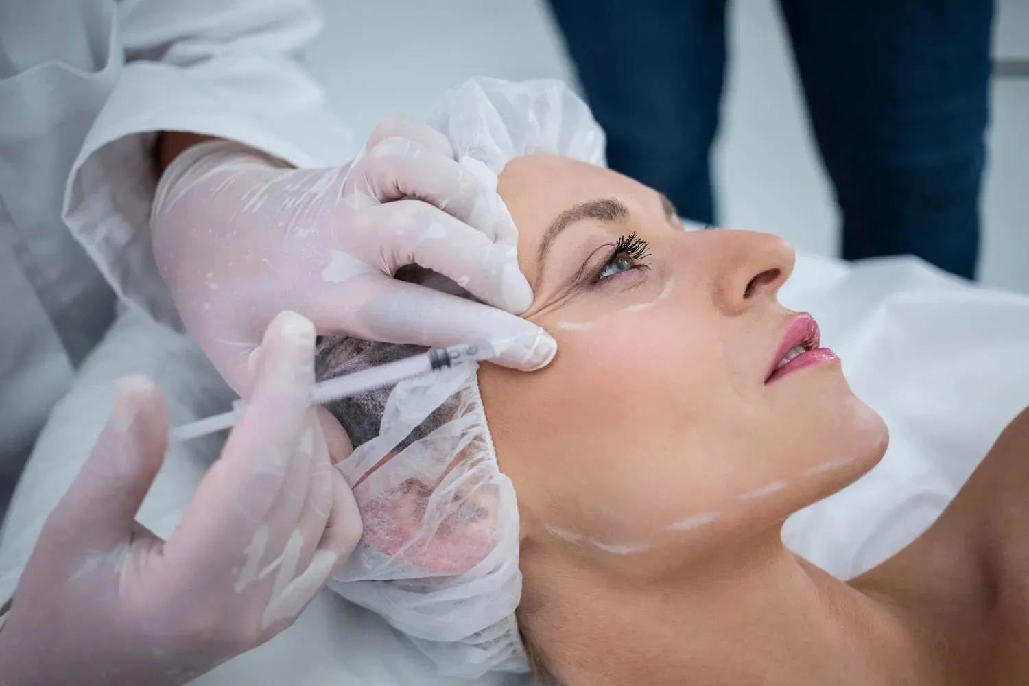 skin mesotherapy Dubai