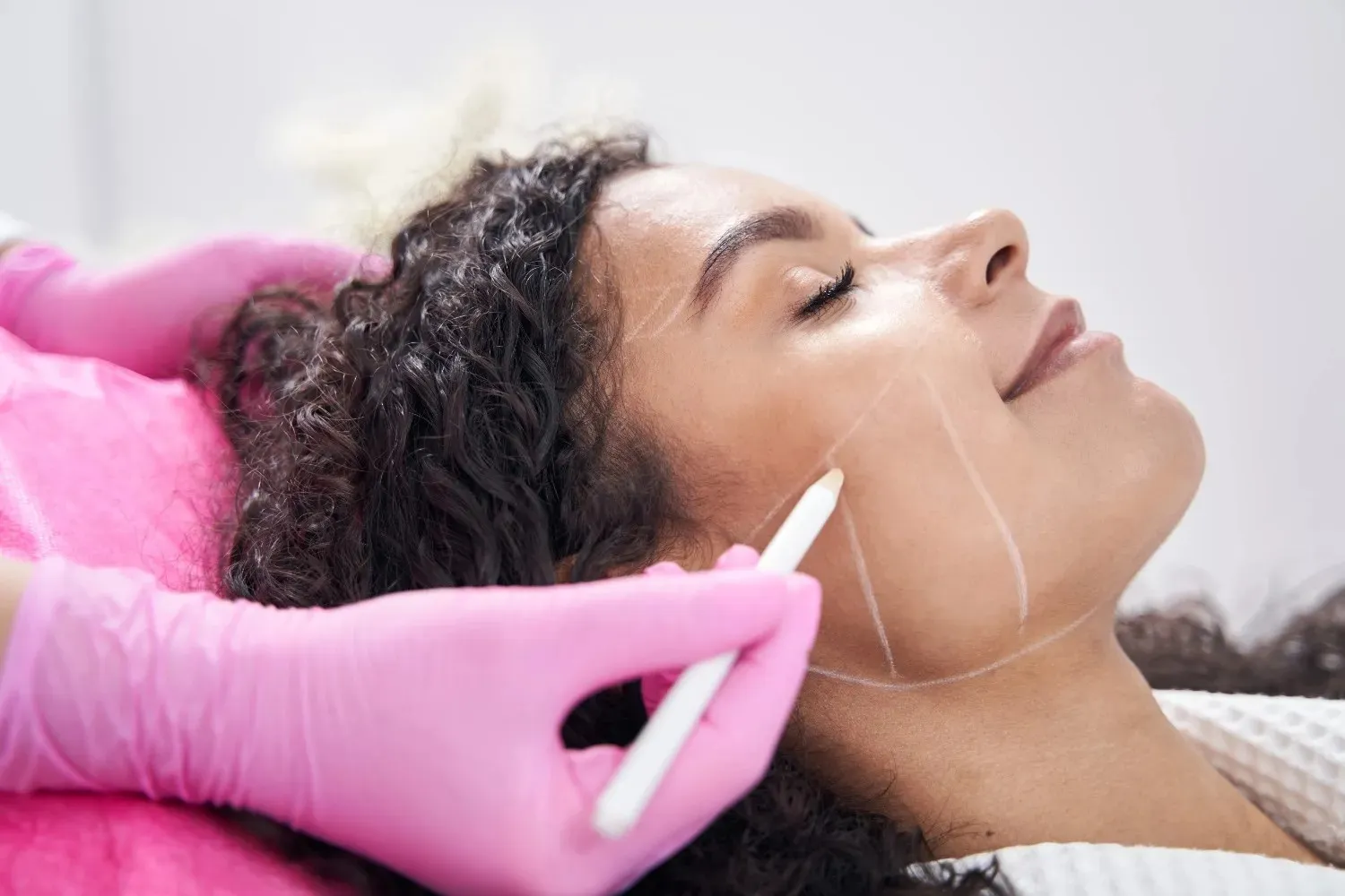 Hydrofacial treatment